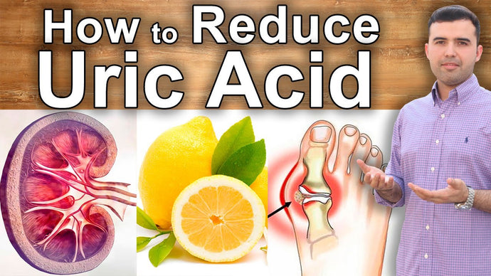 Reducing Uric Acid: Simple Steps &amp; Healthy Foods for a Gout-Free Life